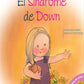 El Sindrome De Down